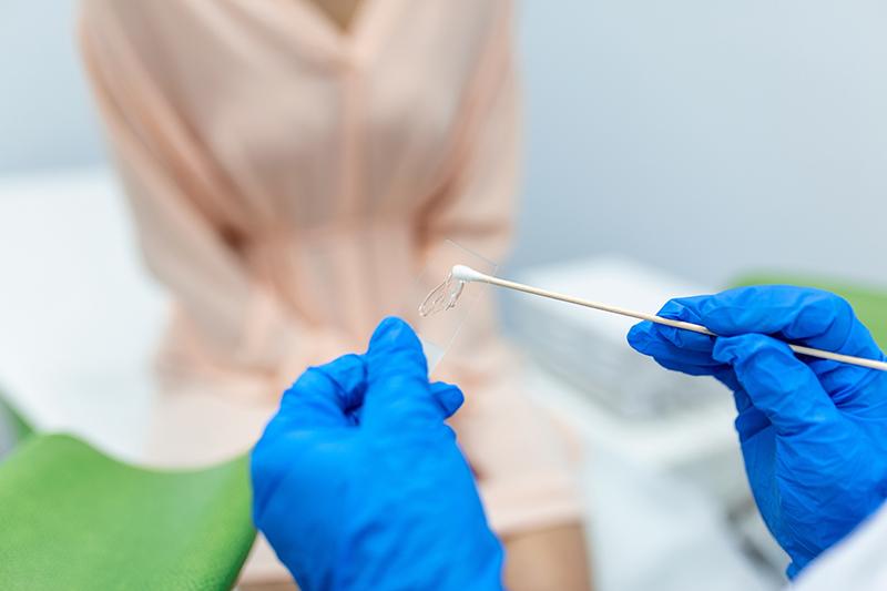 Close-up of a gynaecologist holding a smear sample during pap smear examination