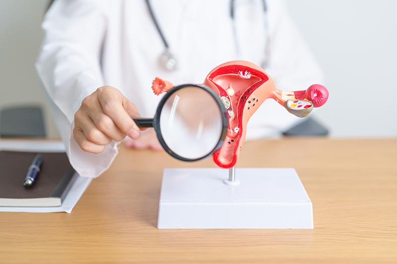A gynaecologist examining an anatomical model of a uterus