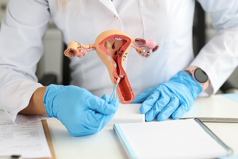 A gynaecologist pointing to an anatomical model of the uterus