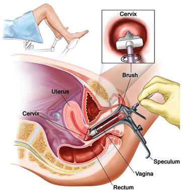 Pap Smear